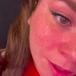 Freckless